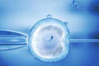 筛查银屑病三代试管来帮忙，国内排除准确率真不低！